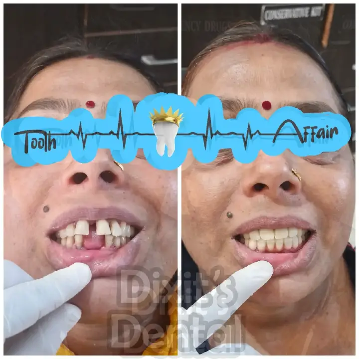 Before and after